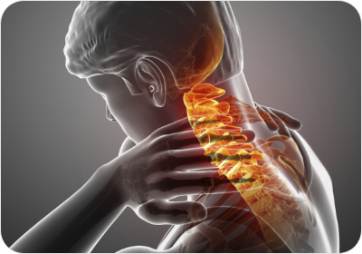 경추 질환