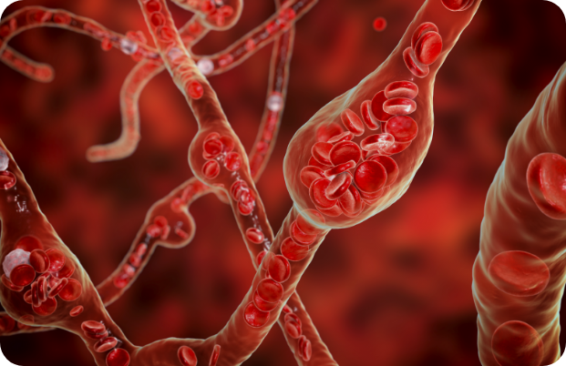 고압산소치료의 효과